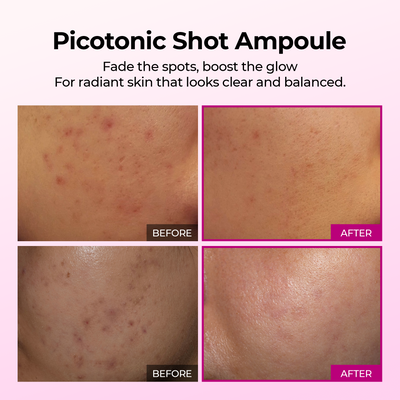 Picotonic Shot Pigmentation Ampoule