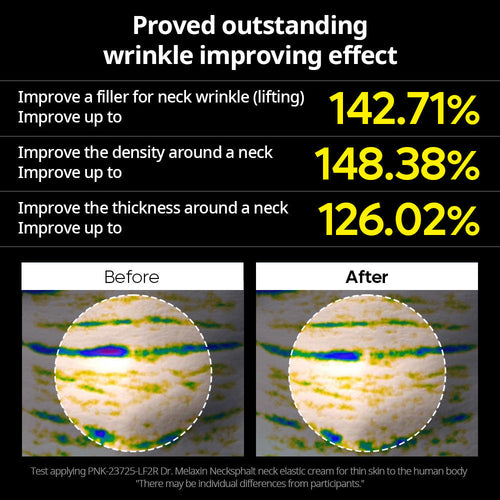 Necksphalt ECM Neck Tightening Line