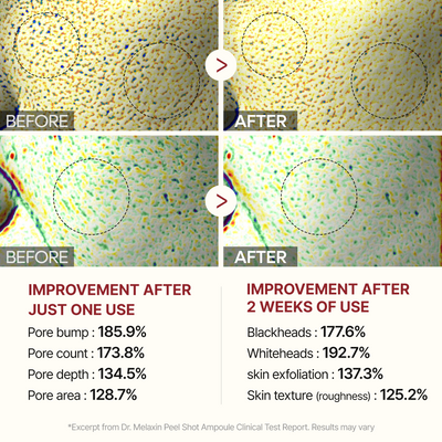 Peel Shot Glow White Rice Ampoule