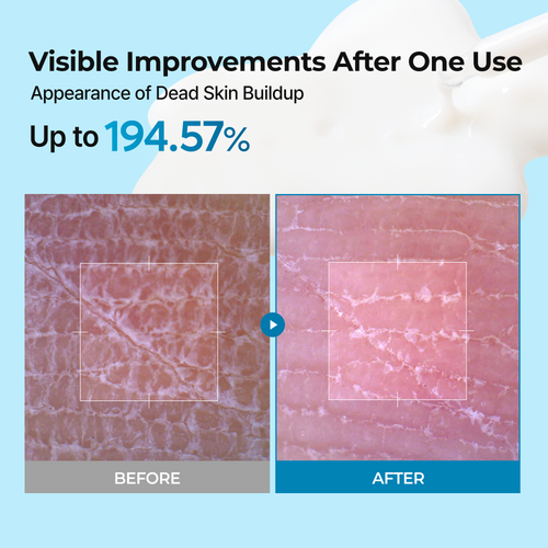 Peel Shot Exfoliating TX Serum