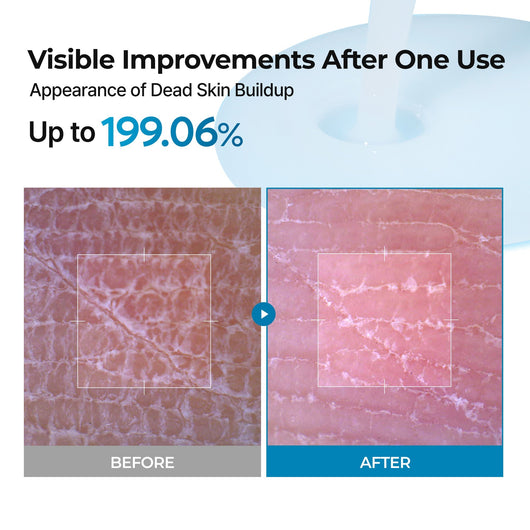 Peel Shot Exfoliating TX Spray